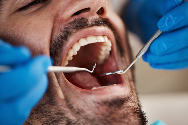 Emergency Dental Services in Deschutes River Woods, OR